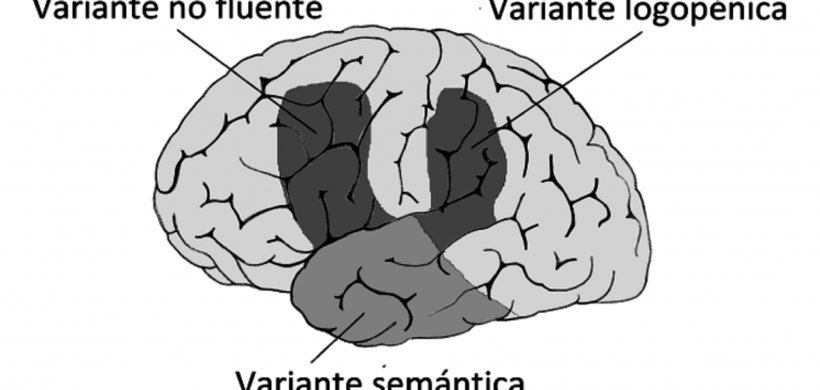 Caracterización del lenguaje en las variantes lingüísticas de la Afasia Progresiva Primaria