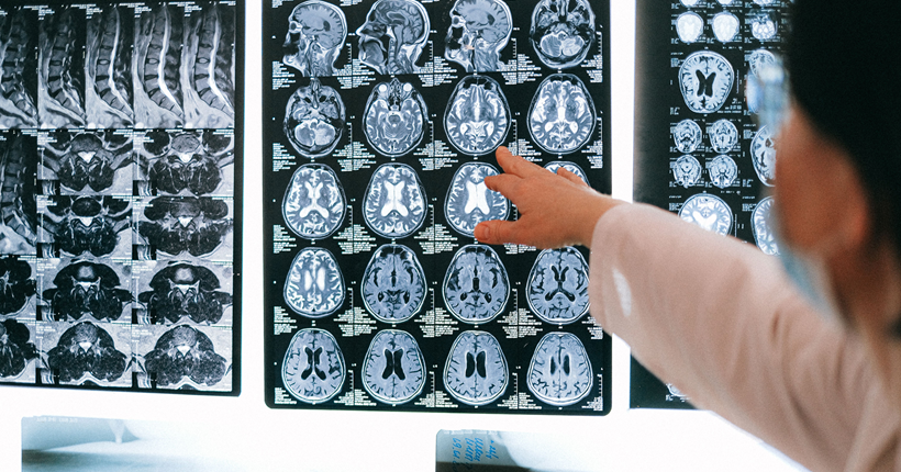 Imagen del cerebro